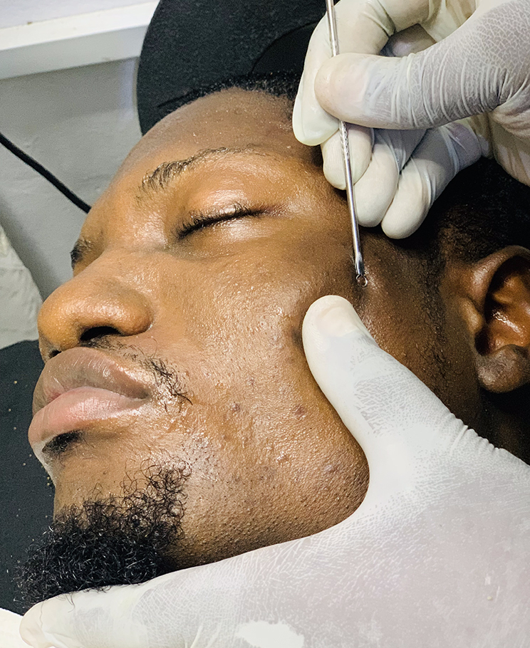 Male facial treatment